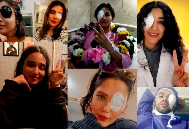 این گزارش گزیدهای از تصاویر و نوشتههای زخمیانی است که از تجربه، احساس، خشم و امید، پس از زخمی شدن چشمشان نوشتهاند