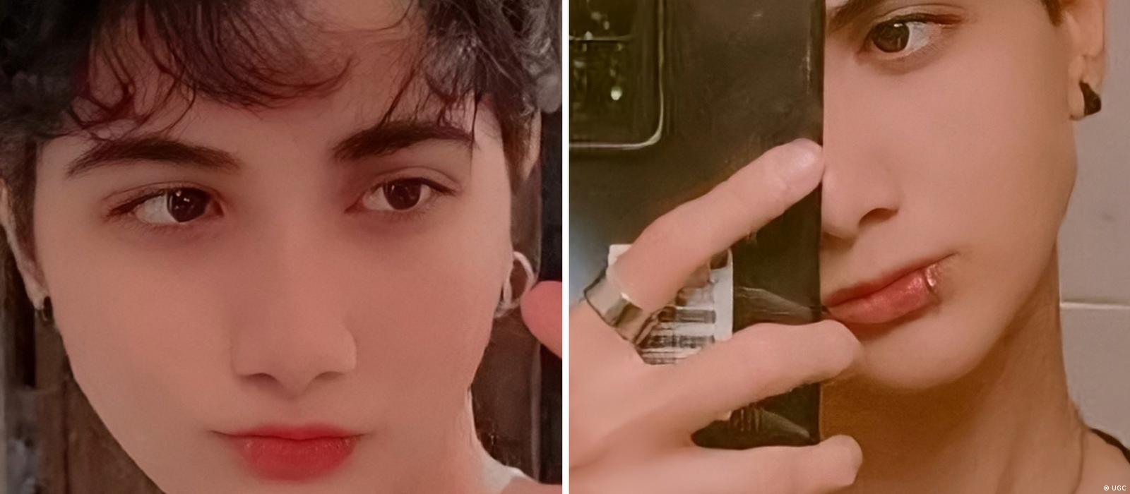 آرمیتا گراوند، دختر ١۶ ساله اهل کرمانشاه و ساکن تهران در کماست