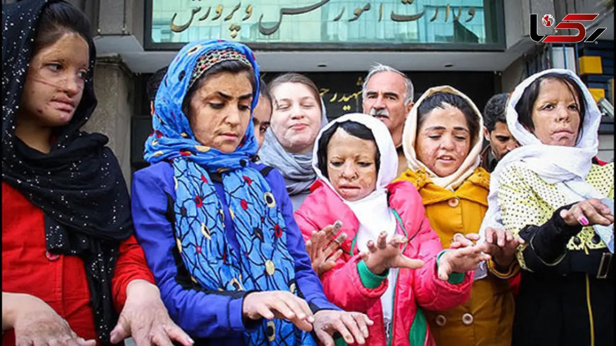 عکس های جگرسوز 13 سال قبل تاکنون / پوست دختران شینآبادی در مدرسه سوخت و دلشان در دوران داشنجویی در دانشگاه / درمان ما قطع شده است و ...